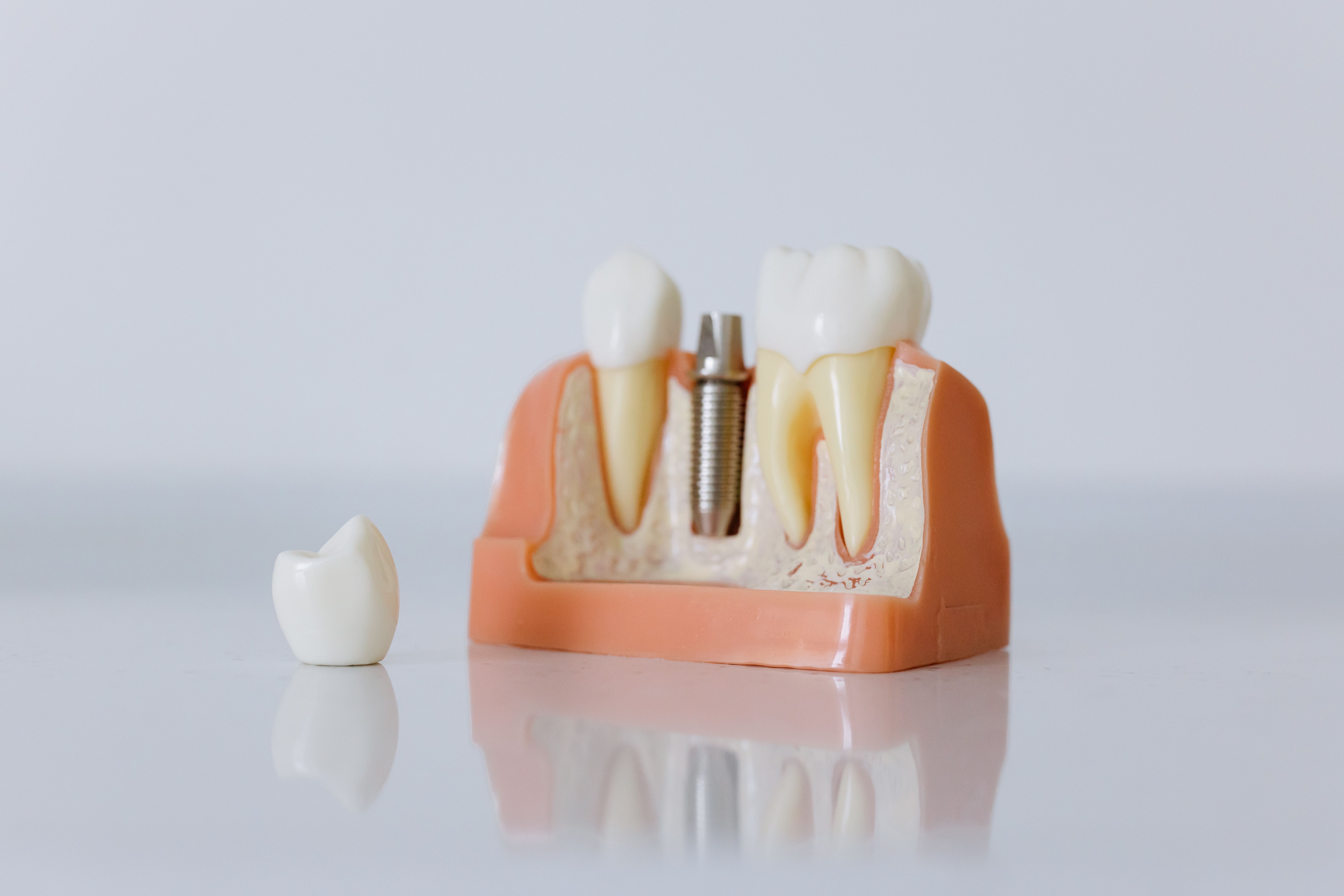 Dental chair